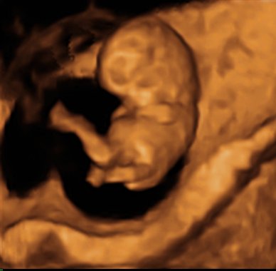 Pregnant 8 ultrasound weeks 8 Weeks