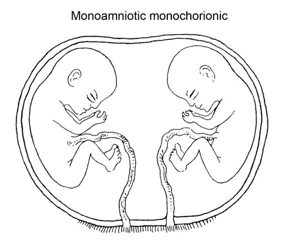 mono-mono twins