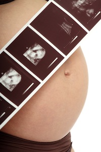 Pregnant with ultrasound photos