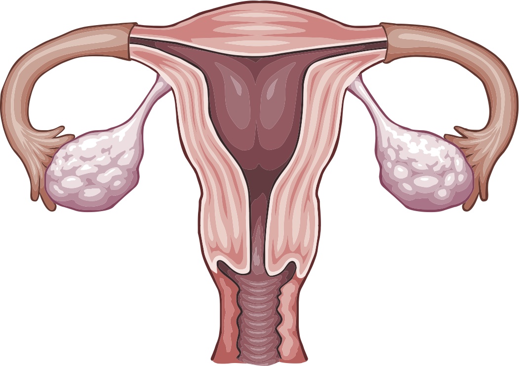 ovarian-cancer.jpg