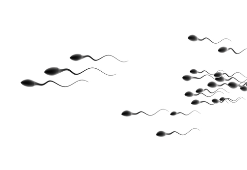 Abnormal Semen Anaylsis Sperm Count