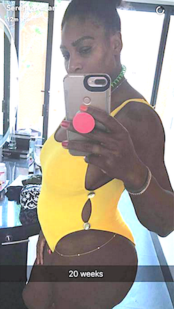 Serena Williams 20 weeks pregnant