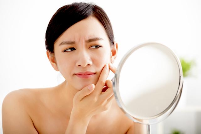 acne pregnancy woman looking at face in mirror