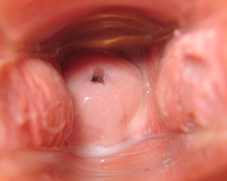 Cervix Cycle Day 14