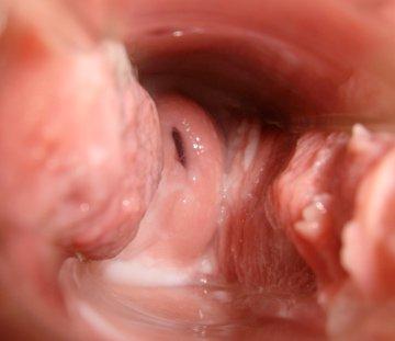 Cervix Cycle Day 21