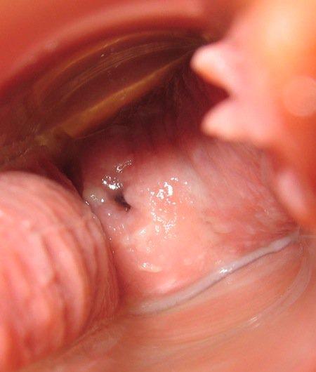 Cervix Cycle Day 9