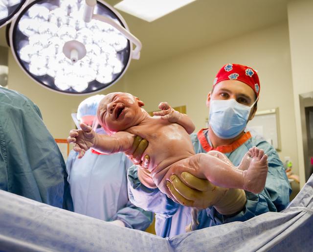 cesarean delivery section and baby