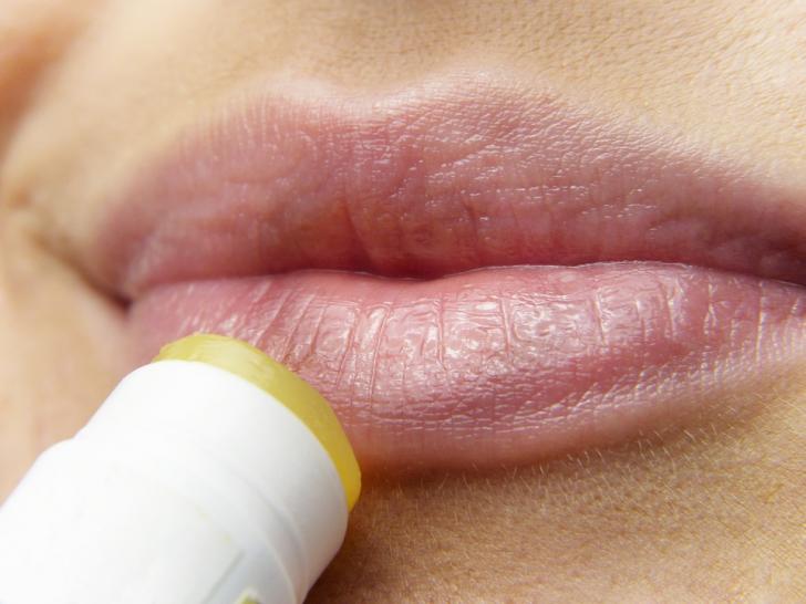 chapped lips, lips pregnancy, pregnant skin changes, dry skin