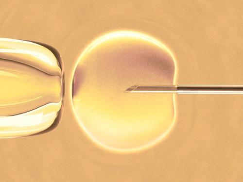 IVF and ICSI, forms of assisted reproductive technology (ART)
