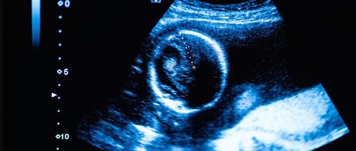 When-Is-the-Earliest-an-Ultrasound-Can-Diagnosis-Pregnancy?