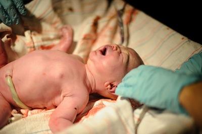 newborn opiate use during pregnancy