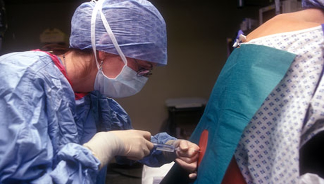 epidural anesthesia pregnancy