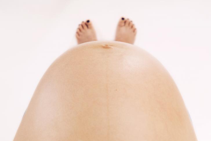 Postdate Postterm Pregnancy