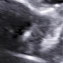 pregnancy fetus week 20 ultrasound