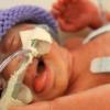 small premature baby neonatal intensive care nicu