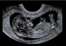 13 Weeks Pregnant Pregnancy Fertility Articles | BabyMed.com