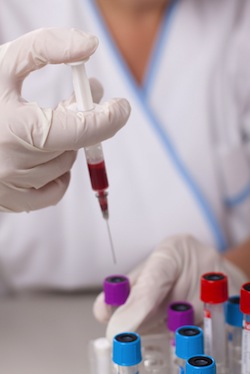 IVF Outcome Blood Test