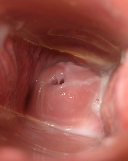 Penis Cumming In Cervix-2653