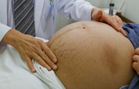 BMI and pregnancy