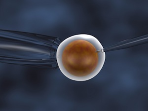 In vitro fertilization (IVF)