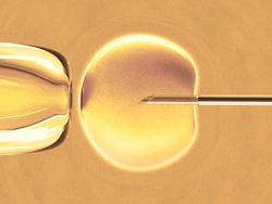 intracytoplasmic sperm injection (ICSI)