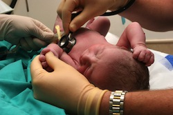 Newborn Evaluation Malonic Aciduria
